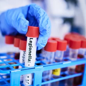 Chemist working in lab - Legionella Control Systems