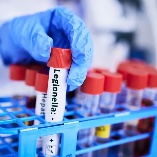 Chemist working in lab - Legionella Control Systems