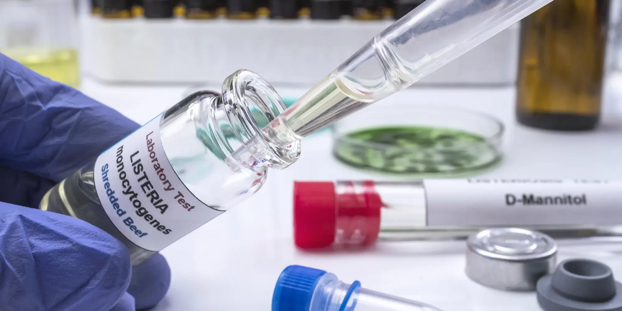 Listeria monocytogenes, a bacterium found in soil, water, and contaminated food, poses significant risks to public health, particularly in the food industry. Listeria monocytogenes, a bacterium found in soil, water, and contaminated food, poses significant risks to public health, particularly in the food industry.